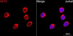 Invitrogen AKT2 Recombinant Rabbit Monoclonal Antibody (5J2K7) 100 &mu;L | Buy Online | Invitrogen&trade; | Fisher Scientific