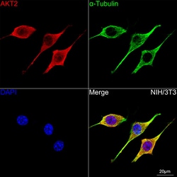 Invitrogen&trade;&nbsp;AKT2 Recombinant Rabbit Monoclonal Antibody (5J2K7)