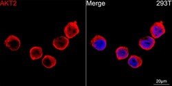 Invitrogen AKT2 Recombinant Rabbit Monoclonal Antibody (5J2K7) 100 &mu;L | Buy Online | Invitrogen&trade; | Fisher Scientific