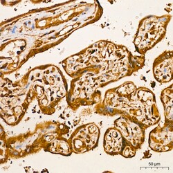 Invitrogen AKT2 Recombinant Rabbit Monoclonal Antibody (5J2K7) 100 &mu;L | Buy Online | Invitrogen&trade; | Fisher Scientific