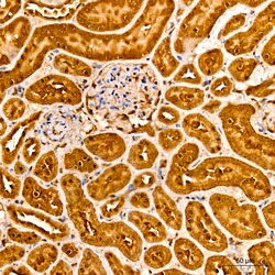 Invitrogen AKT2 Recombinant Rabbit Monoclonal Antibody (5J2K7) 100 &mu;L | Buy Online | Invitrogen&trade; | Fisher Scientific