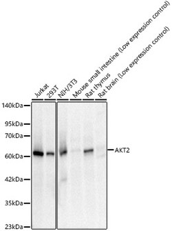 Invitrogen AKT2 Recombinant Rabbit Monoclonal Antibody (5J2K7) 100 &mu;L | Buy Online | Invitrogen&trade; | Fisher Scientific