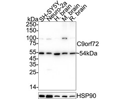 Invitrogen&trade;&nbsp;C9orf72 Recombinant Rabbit Monoclonal Antibody (PSH11-11)