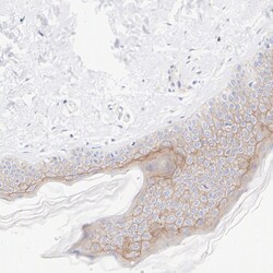 Invitrogen Nectin 4 Recombinant Rabbit Monoclonal Antibody (PSH09-73) 100 &mu;L | Buy Online | Invitrogen&trade; | Fisher Scientific
