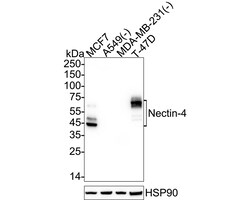 Invitrogen Nectin 4 Recombinant Rabbit Monoclonal Antibody (PSH09-73) 100 &mu;L | Buy Online | Invitrogen&trade; | Fisher Scientific