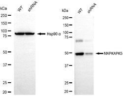 Invitrogen MAPKAPK5 Monoclonal Antibody (25GB5805) 20 &mu;L | Buy Online | Invitrogen&trade; | Fisher Scientific