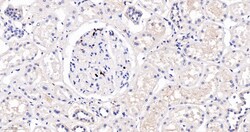 Invitrogen ZO-1 Recombinant Rabbit Monoclonal Antibody (9E12) 100 &mu;L | Buy Online | Invitrogen&trade; | Fisher Scientific