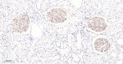 Invitrogen ZO-1 Recombinant Rabbit Monoclonal Antibody (9E12) 100 &mu;L | Buy Online | Invitrogen&trade; | Fisher Scientific