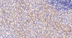 Invitrogen ZO-1 Recombinant Rabbit Monoclonal Antibody (9E12) 100 &mu;L | Buy Online | Invitrogen&trade; | Fisher Scientific