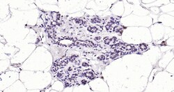 Invitrogen ErbB2 Monoclonal Antibody (12B9) 100 &mu;L | Buy Online | Invitrogen&trade; | Fisher Scientific
