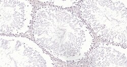 Invitrogen ErbB2 Monoclonal Antibody (12B9) 100 &mu;L | Buy Online | Invitrogen&trade; | Fisher Scientific