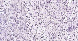 Invitrogen ErbB2 Monoclonal Antibody (12B9) 100 &mu;L | Buy Online | Invitrogen&trade; | Fisher Scientific