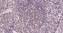 Invitrogen Phospho-JAK2 (Tyr1007, Tyr1008) Recombinant Rabbit Monoclonal Antibody (6E5) 100 &mu;L | Buy Online | Invitrogen&trade; | Fisher Scientific