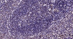 Invitrogen Phospho-JAK2 (Tyr1007, Tyr1008) Recombinant Rabbit Monoclonal Antibody (6E5) 100 &mu;L | Buy Online | Invitrogen&trade; | Fisher Scientific