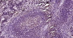 Invitrogen&trade;&nbsp;Phospho-JAK2 (Tyr1007, Tyr1008) Recombinant Rabbit Monoclonal Antibody (6E5)
