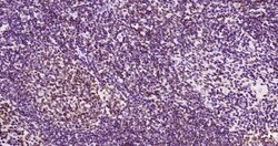 Invitrogen Phospho-JAK2 (Tyr1007, Tyr1008) Recombinant Rabbit Monoclonal Antibody (6E5) 100 &mu;L | Buy Online | Invitrogen&trade; | Fisher Scientific