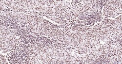 Invitrogen Phospho-JAK2 (Tyr1007, Tyr1008) Recombinant Rabbit Monoclonal Antibody (6E5) 100 &mu;L | Buy Online | Invitrogen&trade; | Fisher Scientific