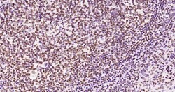 Invitrogen Phospho-JAK2 (Tyr1007, Tyr1008) Recombinant Rabbit Monoclonal Antibody (6E5) 100 &mu;L | Buy Online | Invitrogen&trade; | Fisher Scientific