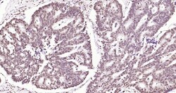 Invitrogen Phospho-JAK2 (Tyr1007, Tyr1008) Recombinant Rabbit Monoclonal Antibody (6E5) 100 &mu;L | Buy Online | Invitrogen&trade; | Fisher Scientific
