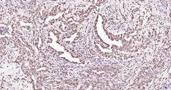 Invitrogen Phospho-JAK2 (Tyr1007, Tyr1008) Recombinant Rabbit Monoclonal Antibody (6E5) 100 &mu;L | Buy Online | Invitrogen&trade; | Fisher Scientific