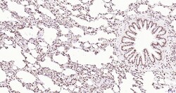 Invitrogen Phospho-JAK2 (Tyr1007, Tyr1008) Recombinant Rabbit Monoclonal Antibody (6E5) 100 &mu;L | Buy Online | Invitrogen&trade; | Fisher Scientific