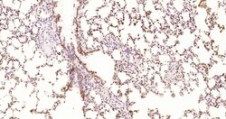 Invitrogen Phospho-JAK2 (Tyr1007, Tyr1008) Recombinant Rabbit Monoclonal Antibody (6E5) 100 &mu;L | Buy Online | Invitrogen&trade; | Fisher Scientific