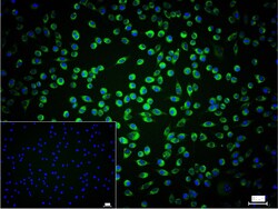 Invitrogen Calreticulin Recombinant Rabbit Monoclonal Antibody (3D1) 100 &mu;L | Buy Online | Invitrogen&trade; | Fisher Scientific