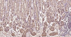 Invitrogen&trade;&nbsp;Calreticulin Recombinant Rabbit Monoclonal Antibody (3D1)
