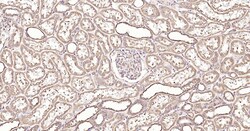 Invitrogen Calreticulin Recombinant Rabbit Monoclonal Antibody (3D1) 100 &mu;L | Buy Online | Invitrogen&trade; | Fisher Scientific