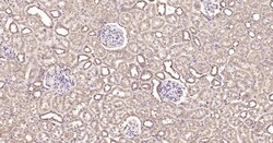 Invitrogen Calreticulin Recombinant Rabbit Monoclonal Antibody (3D1) 100 &mu;L | Buy Online | Invitrogen&trade; | Fisher Scientific