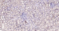Invitrogen Calreticulin Recombinant Rabbit Monoclonal Antibody (3D1) 100 &mu;L | Buy Online | Invitrogen&trade; | Fisher Scientific
