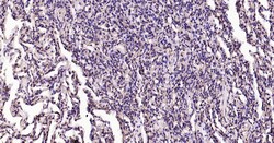 Invitrogen Calreticulin Recombinant Rabbit Monoclonal Antibody (3D1) 100 &mu;L | Buy Online | Invitrogen&trade; | Fisher Scientific