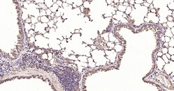 Invitrogen Calreticulin Recombinant Rabbit Monoclonal Antibody (3D1) 100 &mu;L | Buy Online | Invitrogen&trade; | Fisher Scientific