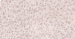 Invitrogen Calreticulin Recombinant Rabbit Monoclonal Antibody (3D1) 100 &mu;L | Buy Online | Invitrogen&trade; | Fisher Scientific
