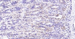 Invitrogen Calreticulin Recombinant Rabbit Monoclonal Antibody (3D1) 100 &mu;L | Buy Online | Invitrogen&trade; | Fisher Scientific