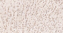 Invitrogen Calreticulin Recombinant Rabbit Monoclonal Antibody (3D1) 100 &mu;L | Buy Online | Invitrogen&trade; | Fisher Scientific