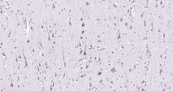 Invitrogen Calreticulin Recombinant Rabbit Monoclonal Antibody (3D1) 100 &mu;L | Buy Online | Invitrogen&trade; | Fisher Scientific