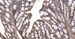 Invitrogen Calreticulin Recombinant Rabbit Monoclonal Antibody (3D1) 100 &mu;L | Buy Online | Invitrogen&trade; | Fisher Scientific
