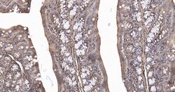 Invitrogen Calreticulin Recombinant Rabbit Monoclonal Antibody (3D1) 100 &mu;L | Buy Online | Invitrogen&trade; | Fisher Scientific