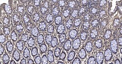 Invitrogen Calreticulin Recombinant Rabbit Monoclonal Antibody (3D1) 100 &mu;L | Buy Online | Invitrogen&trade; | Fisher Scientific
