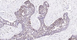 Invitrogen Calreticulin Recombinant Rabbit Monoclonal Antibody (3D1) 100 &mu;L | Buy Online | Invitrogen&trade; | Fisher Scientific