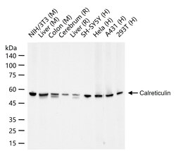 Invitrogen Calreticulin Recombinant Rabbit Monoclonal Antibody (3D1) 100 &mu;L | Buy Online | Invitrogen&trade; | Fisher Scientific