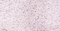 Invitrogen NMDAR2A Recombinant Rabbit Monoclonal Antibody (3C3) 100 &mu;L | Buy Online | Invitrogen&trade; | Fisher Scientific