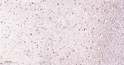 Invitrogen NMDAR2A Recombinant Rabbit Monoclonal Antibody (3C3) 100 &mu;L | Buy Online | Invitrogen&trade; | Fisher Scientific