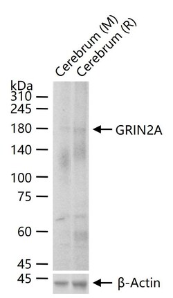 Invitrogen NMDAR2A Recombinant Rabbit Monoclonal Antibody (3C3) 100 &mu;L | Buy Online | Invitrogen&trade; | Fisher Scientific