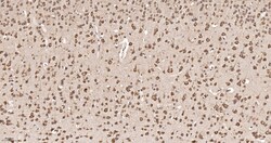 Invitrogen eIF1AX Recombinant Rabbit Monoclonal Antibody (1E8) 100 &mu;L | Buy Online | Invitrogen&trade; | Fisher Scientific