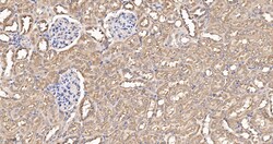 Invitrogen eIF1AX Recombinant Rabbit Monoclonal Antibody (1E8) 100 &mu;L | Buy Online | Invitrogen&trade; | Fisher Scientific