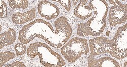 Invitrogen eIF1AX Recombinant Rabbit Monoclonal Antibody (1E8) 100 &mu;L | Buy Online | Invitrogen&trade; | Fisher Scientific