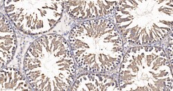 Invitrogen eIF1AX Recombinant Rabbit Monoclonal Antibody (1E8) 100 &mu;L | Buy Online | Invitrogen&trade; | Fisher Scientific