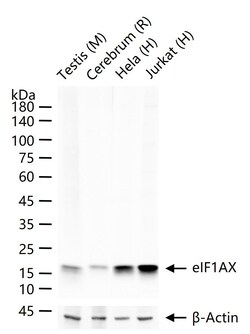 Invitrogen eIF1AX Recombinant Rabbit Monoclonal Antibody (1E8) 100 &mu;L | Buy Online | Invitrogen&trade; | Fisher Scientific